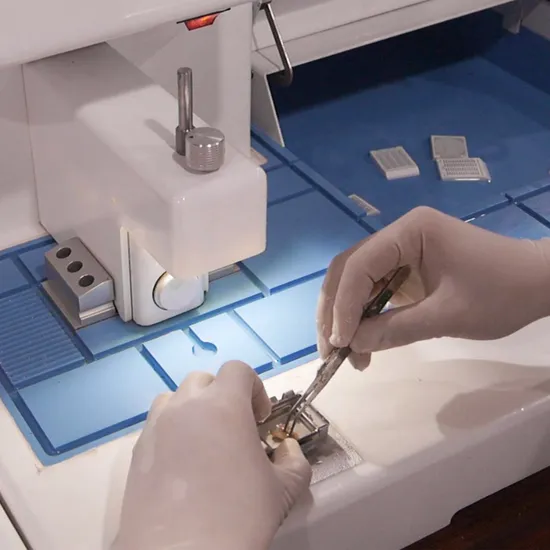 Einbettungszentren maschineller Röntgenhörhörer Audiometer Blutzuckermesser Monitor tragbare Analyse Einbettungszentren