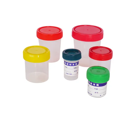 Hochwertiger OEM ODM Laborinstrumentenpreis Hämatologie Analysator Petrischale Probebehälter